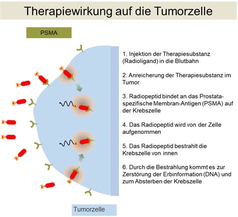 psma liganden therapie heidelberg